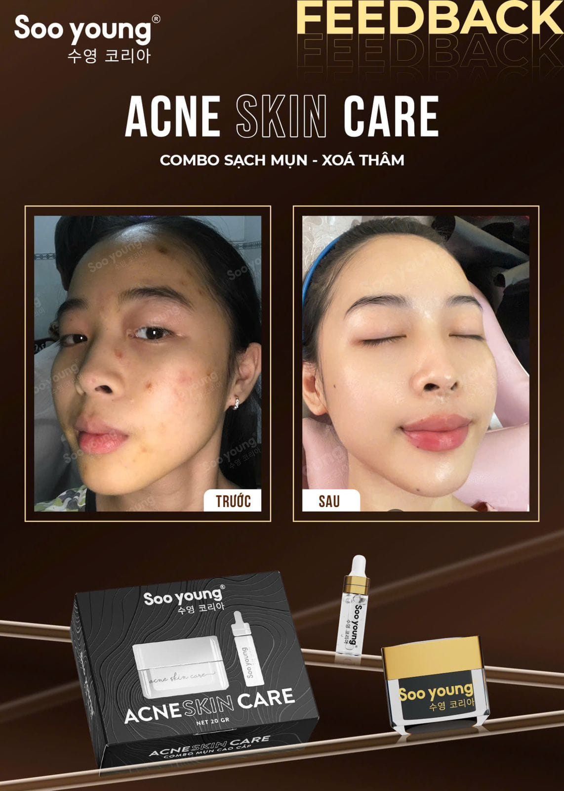 Acne Skin Care Soo Young Anti-Acne Combo Set 4