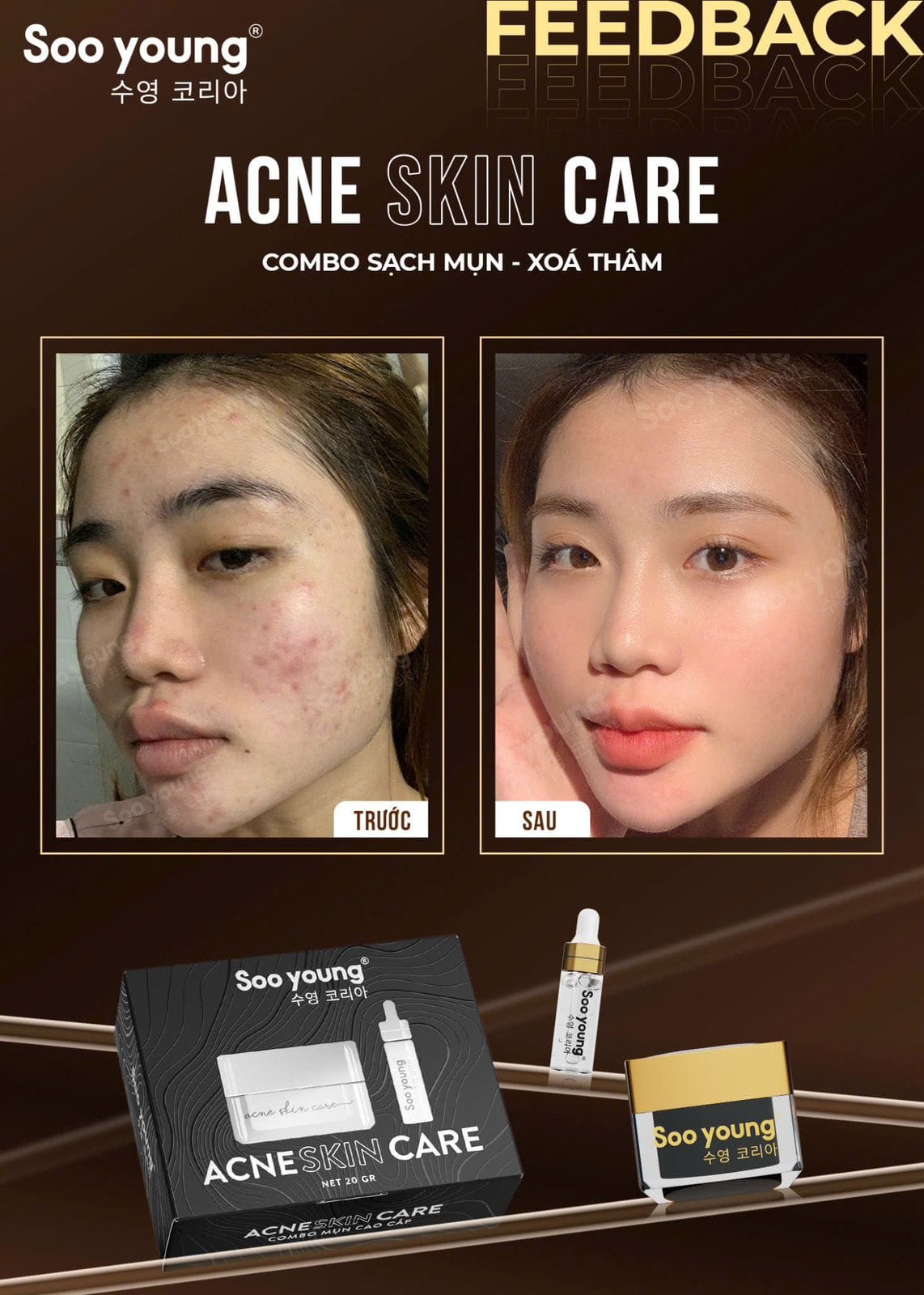 Acne Skin Care Soo Young Anti-Acne Combo Set 4