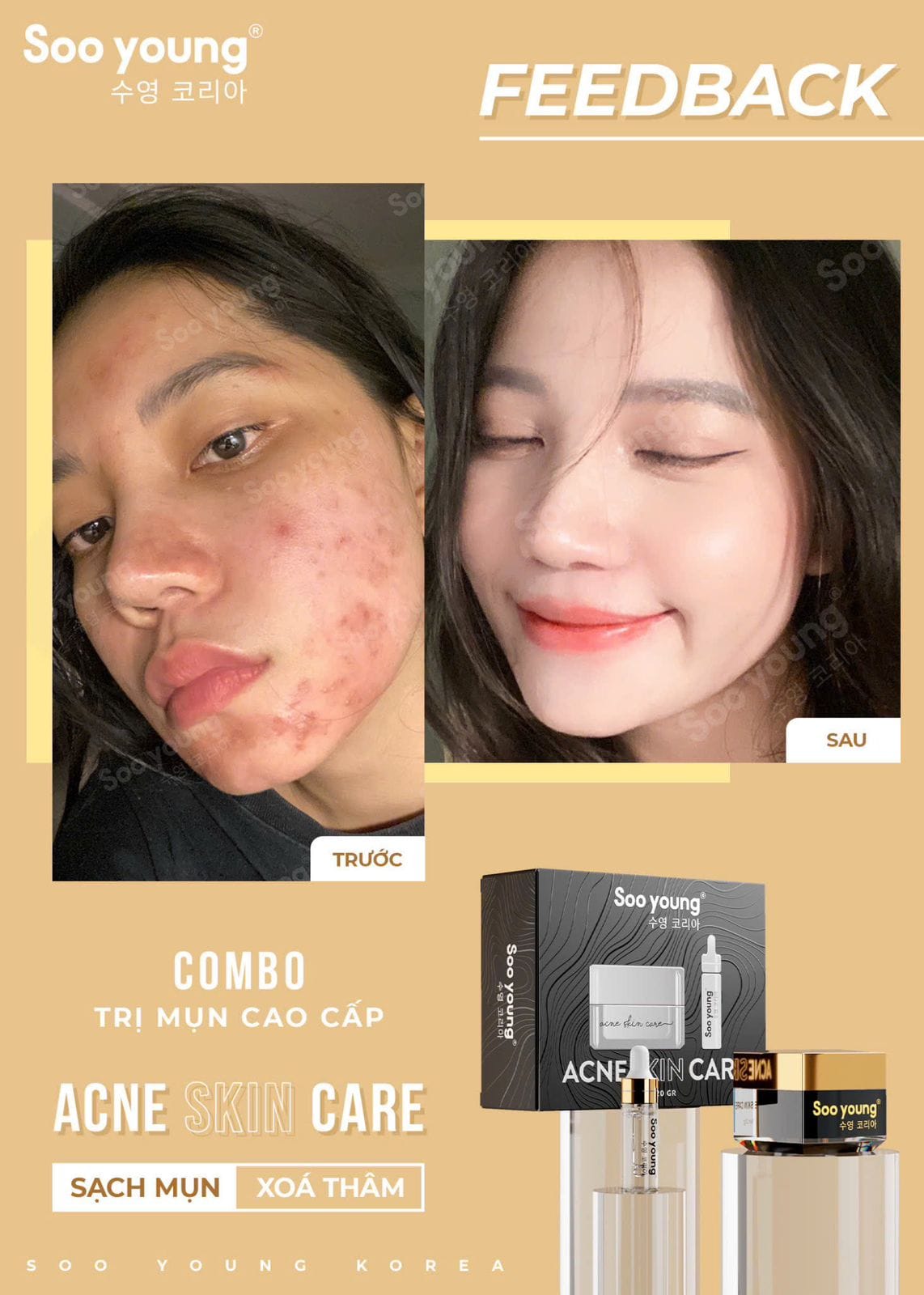 Acne Skin Care Soo Young Anti-Acne Combo Set 4